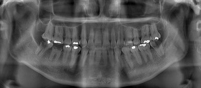 2017.04.05 CT_R23.jpg